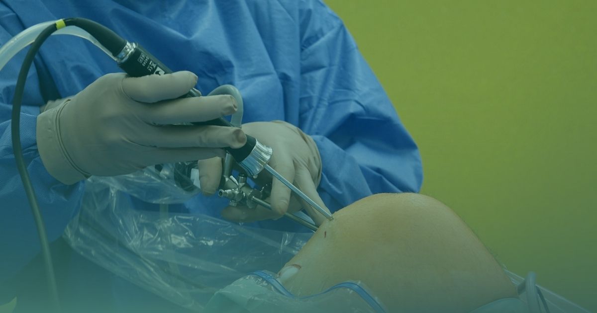 BEAR Implant for ACL Injuries: Repair vs Reconstruction