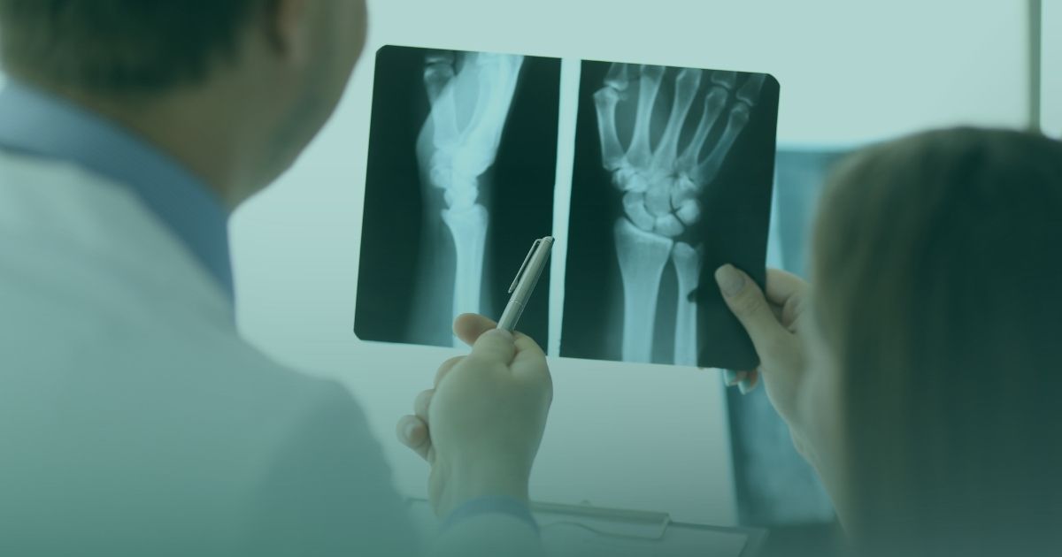 Why Long-Term Data Collection Matters in Orthopedic Research